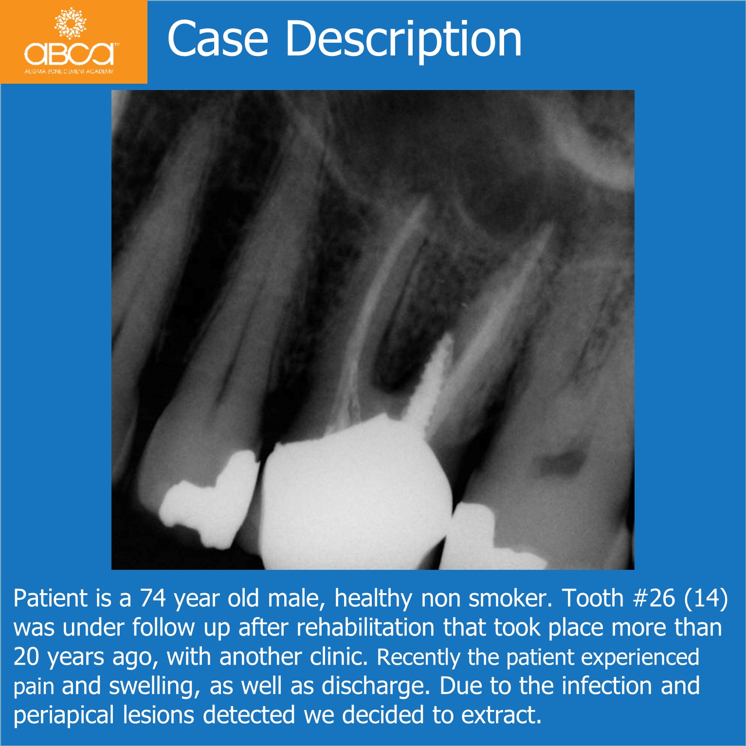 Clinical Case